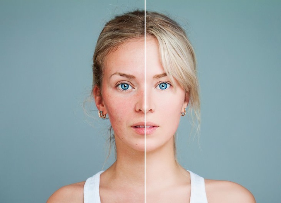 Ai là người tuyệt đối không nên uống sữa bò? - 5 Ai là người tuyệt đối không nên uống sữa bò? - 5