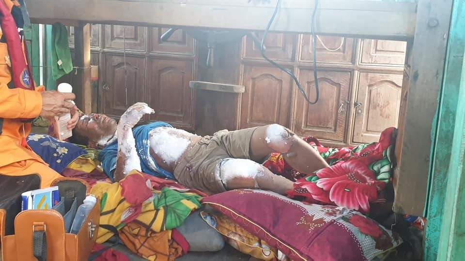 Qua điện đàm, cấp cứu thành công ngư dân bị bỏng nặng toàn thân - 1