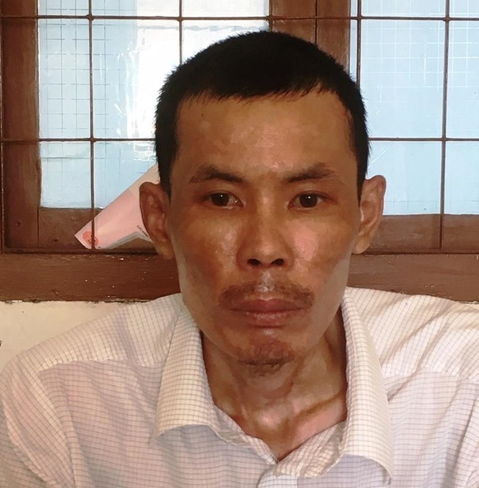 Khởi tố, bắt tạm giam người chồng thiêu sống vợ bằng xăng - 1 Khởi tố, bắt tạm giam người chồng thiêu sống vợ bằng xăng - 1