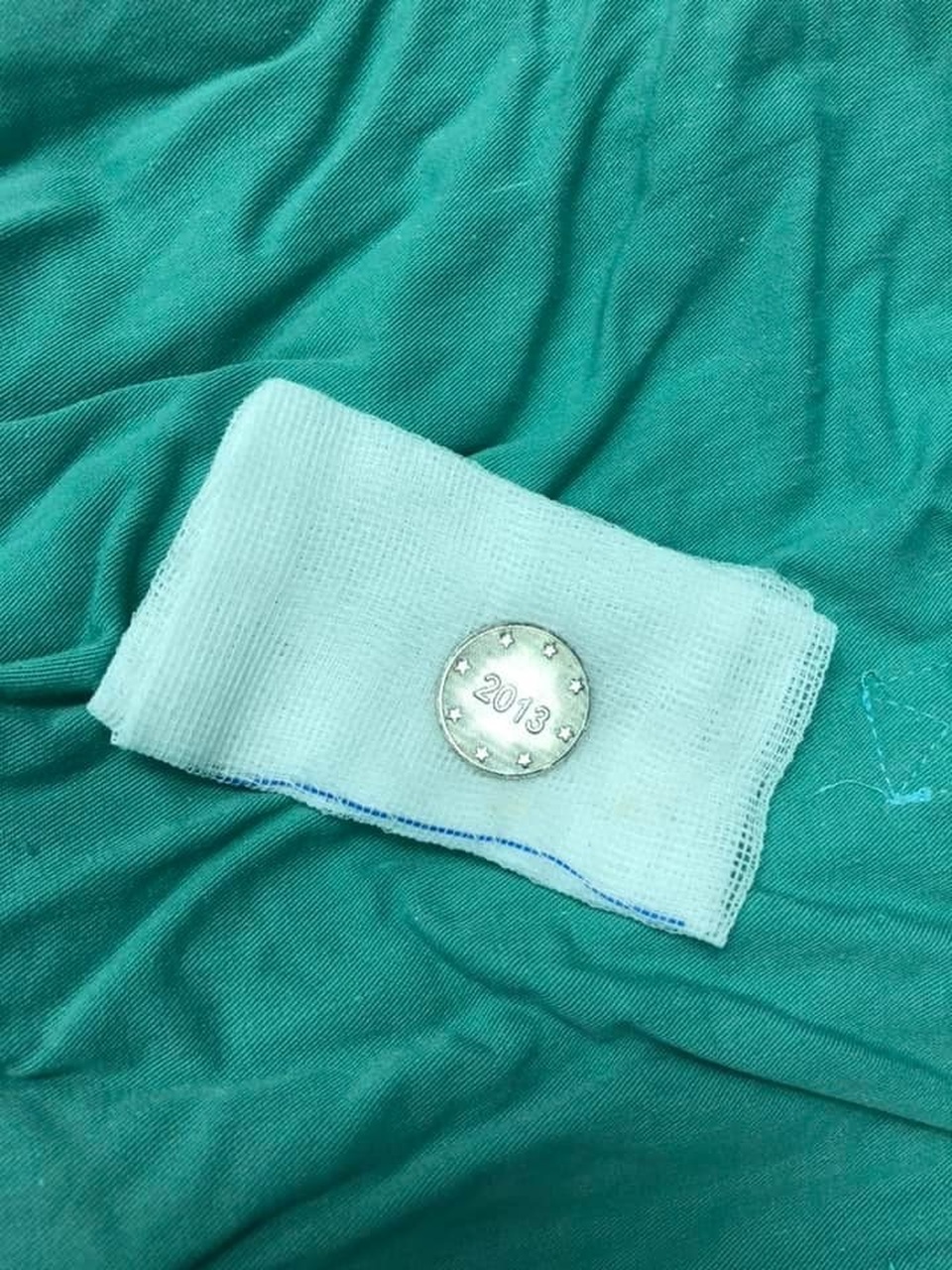 Quảng Bình: Chơi đồng xu, bé trai 5 tuổi nuốt luôn vào thực quản - 3