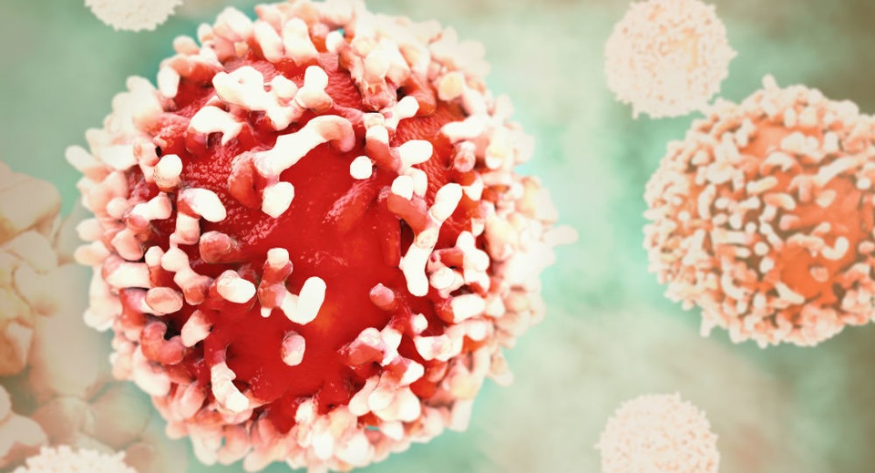 Ăn kiêng như thế nào để chống ung thư? - 1 Ăn kiêng như thế nào để chống ung thư? - 1