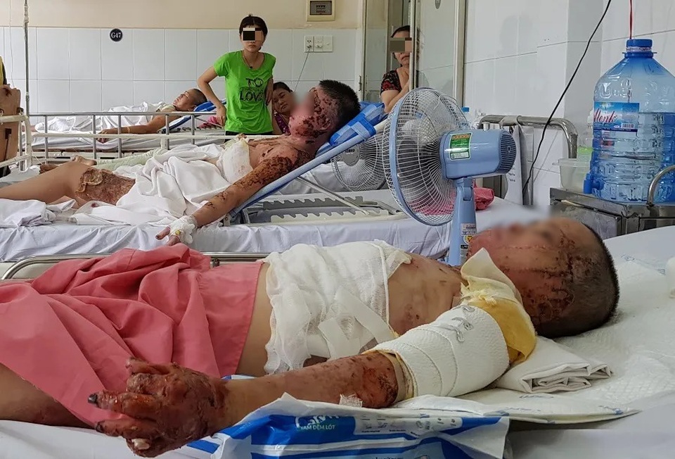 Vợ thành “đuốc sống” vì điếu thuốc lá của chồng - 2