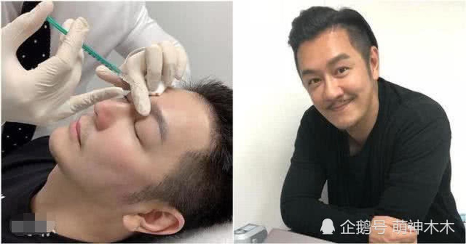 “Đoàn Dự” Trần Hạo Dân phẫu thuật thẩm mỹ níu giữ tuổi xuân - 4 “Đoàn Dự” Trần Hạo Dân phẫu thuật thẩm mỹ níu giữ tuổi xuân - 4