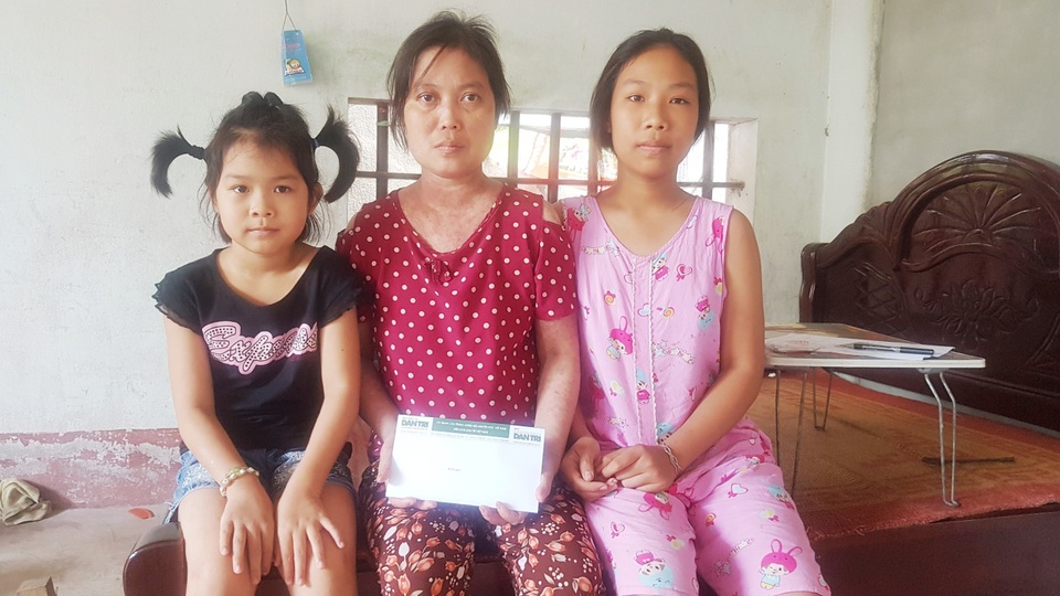 Mẹ con chị “Thơm Lupus ban đỏ” được bạn đọc giúp đỡ thêm 20 triệu đồng - 4 Mẹ con chị “Thơm Lupus ban đỏ” được bạn đọc giúp đỡ thêm 20 triệu đồng - 4