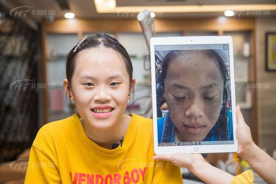 Ngày hội làm đẹp cho tất cả mọi người - không thể thiếu những mảnh đời bất hạnh! - 6 Ngày hội làm đẹp cho tất cả mọi người - không thể thiếu những mảnh đời bất hạnh! - 6