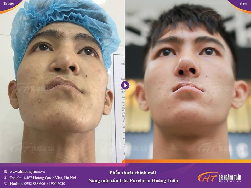 Ngày hội làm đẹp cho tất cả mọi người - không thể thiếu những mảnh đời bất hạnh! - 7 Ngày hội làm đẹp cho tất cả mọi người - không thể thiếu những mảnh đời bất hạnh! - 7
