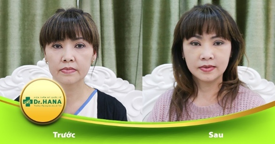 Bác sĩ Nguyễn Công Hân – Người xóa đi ám ảnh chảy xệ da tuổi trung niên - 3