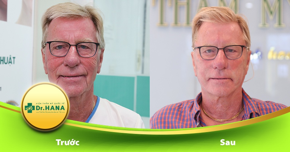 Bác sĩ Nguyễn Công Hân – Người xóa đi ám ảnh chảy xệ da tuổi trung niên - 4