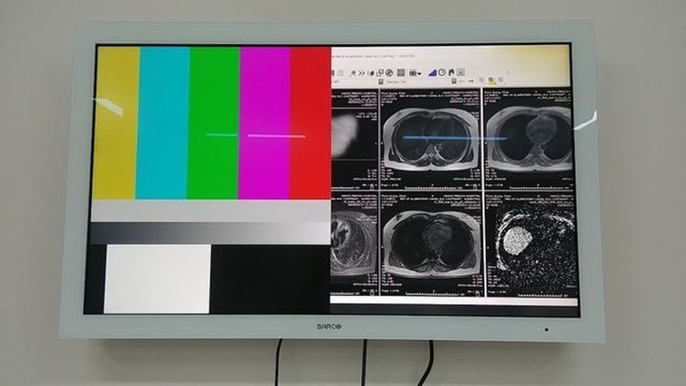 Vì sao nhiều bệnh viện lớn sử dụng màn hình y tế trong chẩn đoán hình ảnh? - 2 Vì sao nhiều bệnh viện lớn sử dụng màn hình y tế trong chẩn đoán hình ảnh? - 2