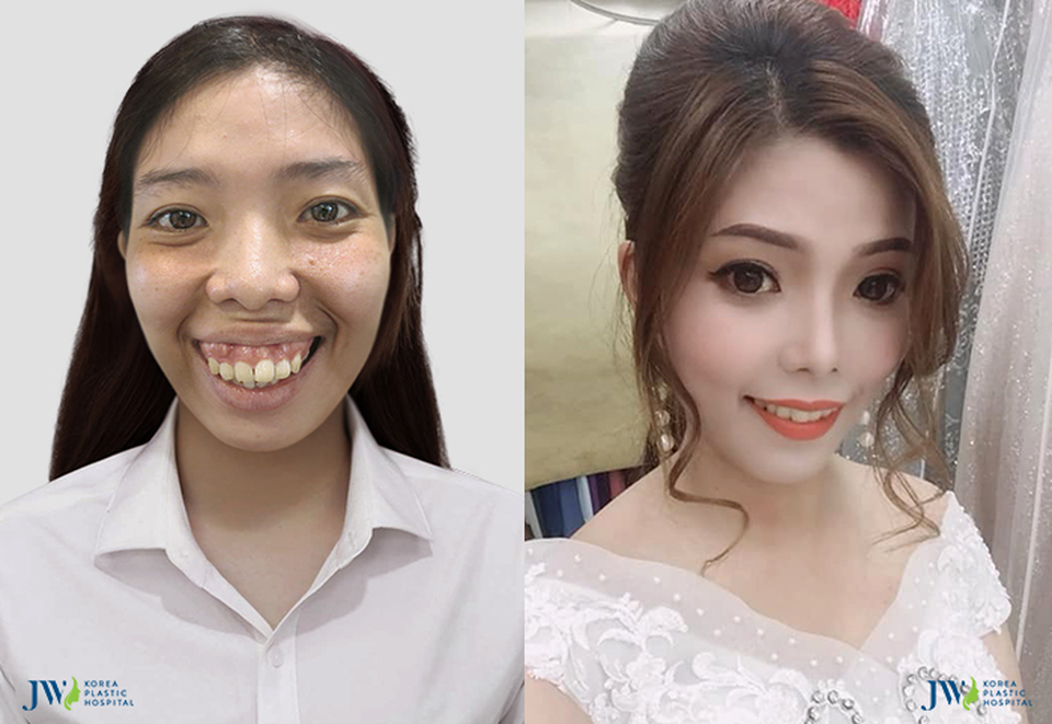 Hỗ trợ phẫu thuật miễn phí cho hàng nghìn trường hợp mắc khuyết điểm - 4