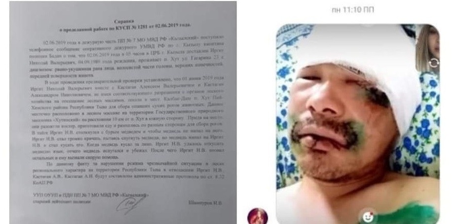 Thoát chết trong gang tấc nhờ … cắn vào lưỡi gấu - 2