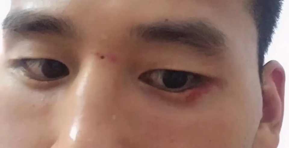 Clip “võ sư Trung Quốc xin thua rồi bất ngờ đánh lén đối thủ” khiến dân mạng chê cười - 2