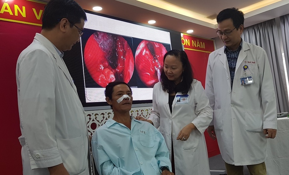 “Bỏ quên” chiếc đũa suốt 4 năm trong hốc mắt - 3 “Bỏ quên” chiếc đũa suốt 4 năm trong hốc mắt - 3