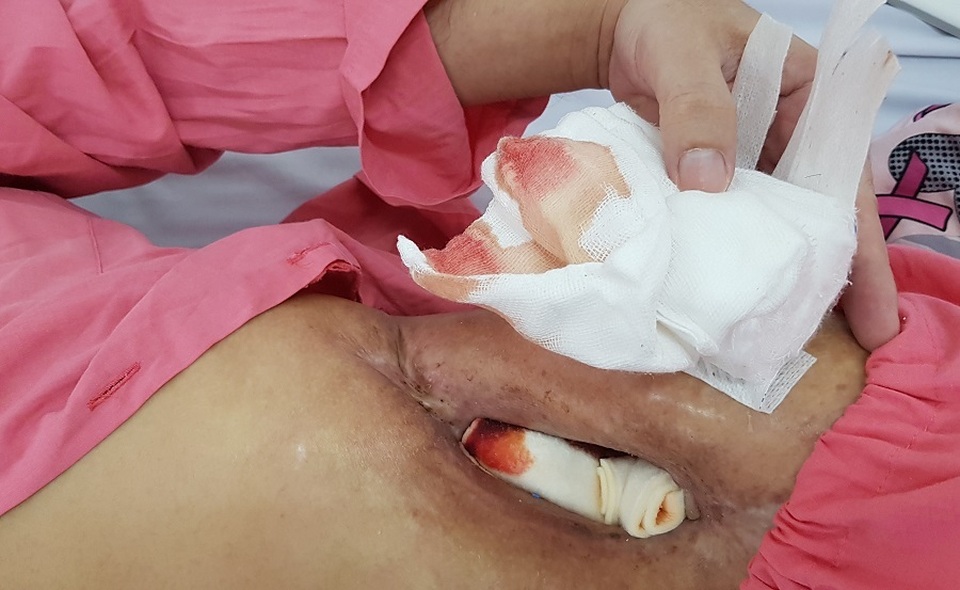 Mong muốn của bệnh nhân mắc bệnh máu khó đông - 3 Mong muốn của bệnh nhân mắc bệnh máu khó đông - 3