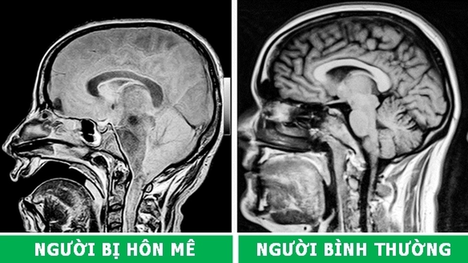 Những hình chụp X-quang giúp chúng ta hiểu hơn về cơ thể mình - 1 Những hình chụp X-quang giúp chúng ta hiểu hơn về cơ thể mình - 1