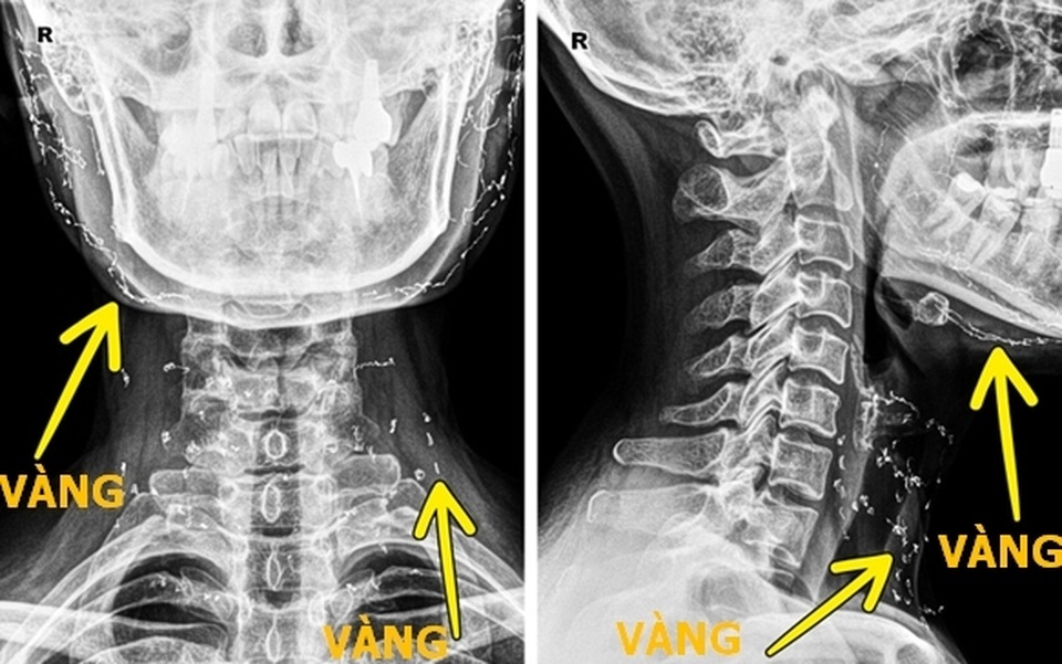 Những hình chụp X-quang giúp chúng ta hiểu hơn về cơ thể mình - 2 Những hình chụp X-quang giúp chúng ta hiểu hơn về cơ thể mình - 2