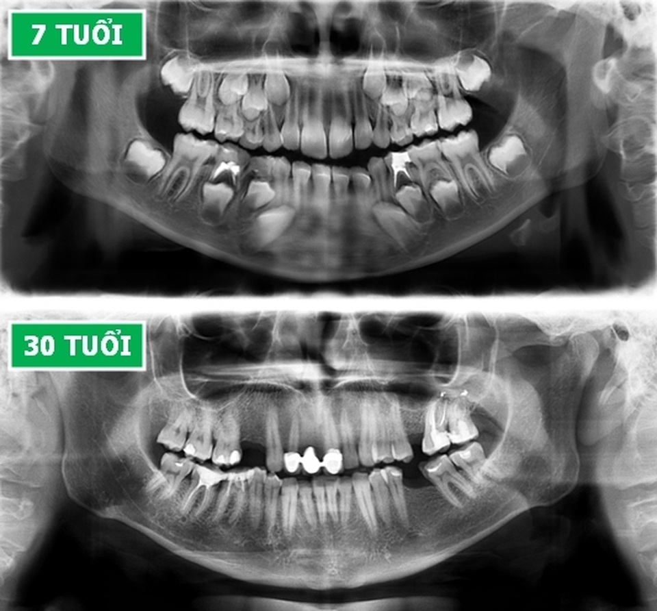 Những hình chụp X-quang giúp chúng ta hiểu hơn về cơ thể mình - 6 Những hình chụp X-quang giúp chúng ta hiểu hơn về cơ thể mình - 6