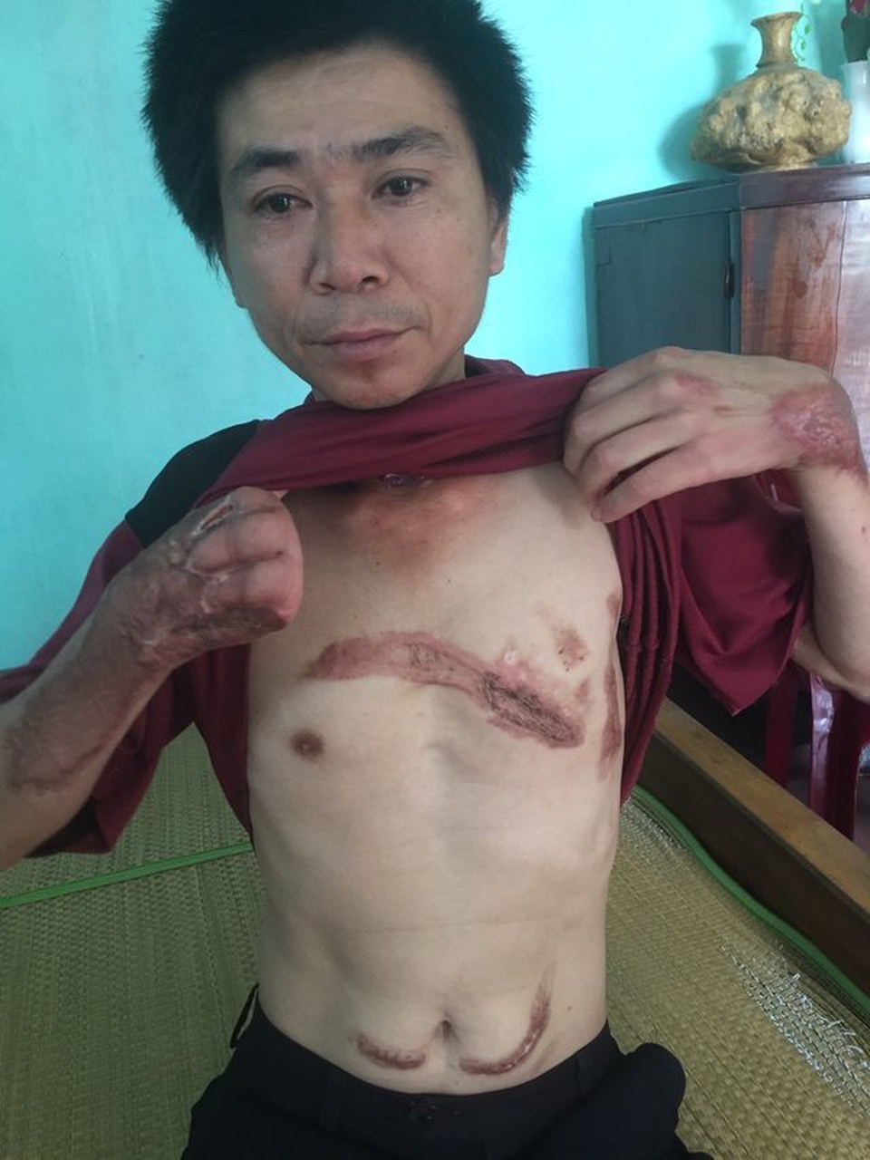 Hơn 67 triệu đồng của bạn đọc giúp đỡ cụ bà mò cua bắt ốc nuôi con trai động kinh - 3 Hơn 67 triệu đồng của bạn đọc giúp đỡ cụ bà mò cua bắt ốc nuôi con trai động kinh - 3