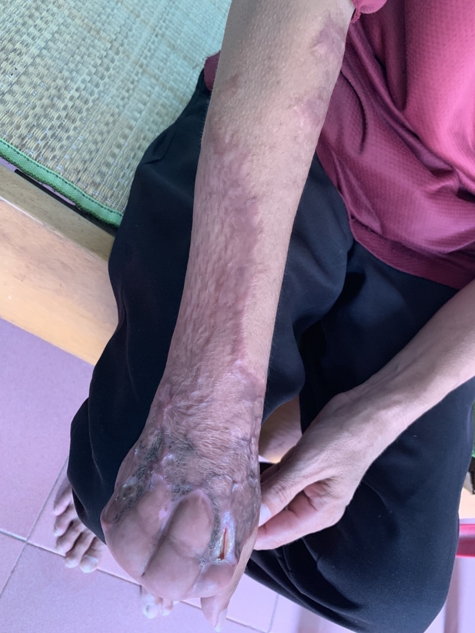 Hơn 67 triệu đồng của bạn đọc giúp đỡ cụ bà mò cua bắt ốc nuôi con trai động kinh - 4 Hơn 67 triệu đồng của bạn đọc giúp đỡ cụ bà mò cua bắt ốc nuôi con trai động kinh - 4