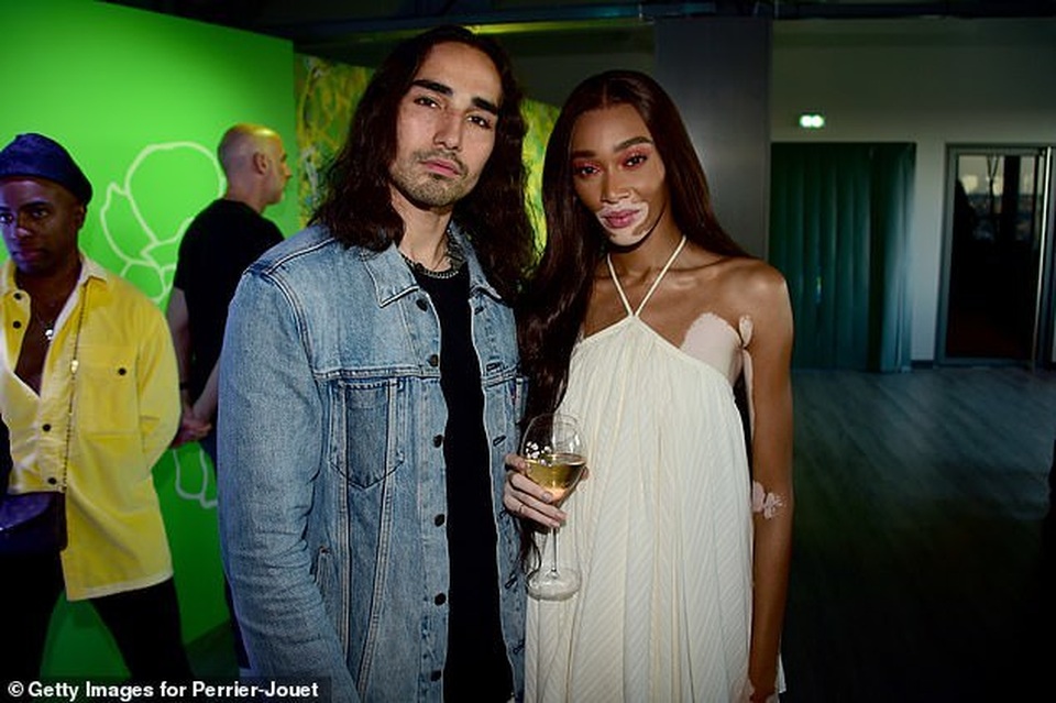 Winnie Harlow xinh đẹp hút hồn - 7 Winnie Harlow xinh đẹp hút hồn - 7