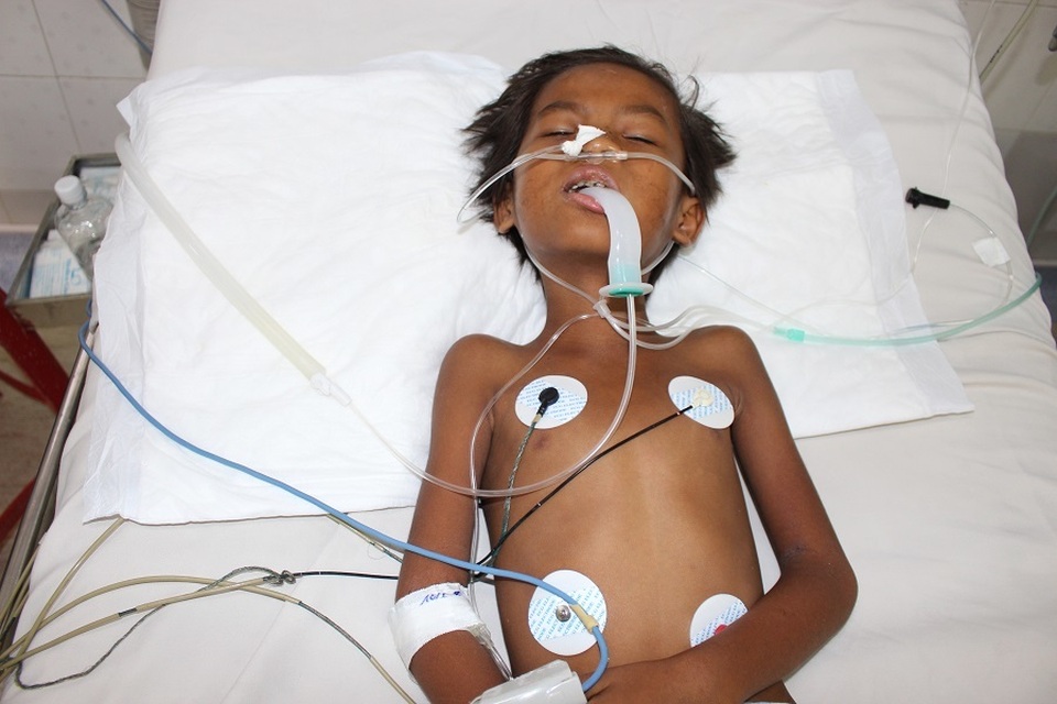 Xót xa cậu bé dân tộc Stiêng chỉ còn da bọc xương thoi thóp trên giường bệnh - 4