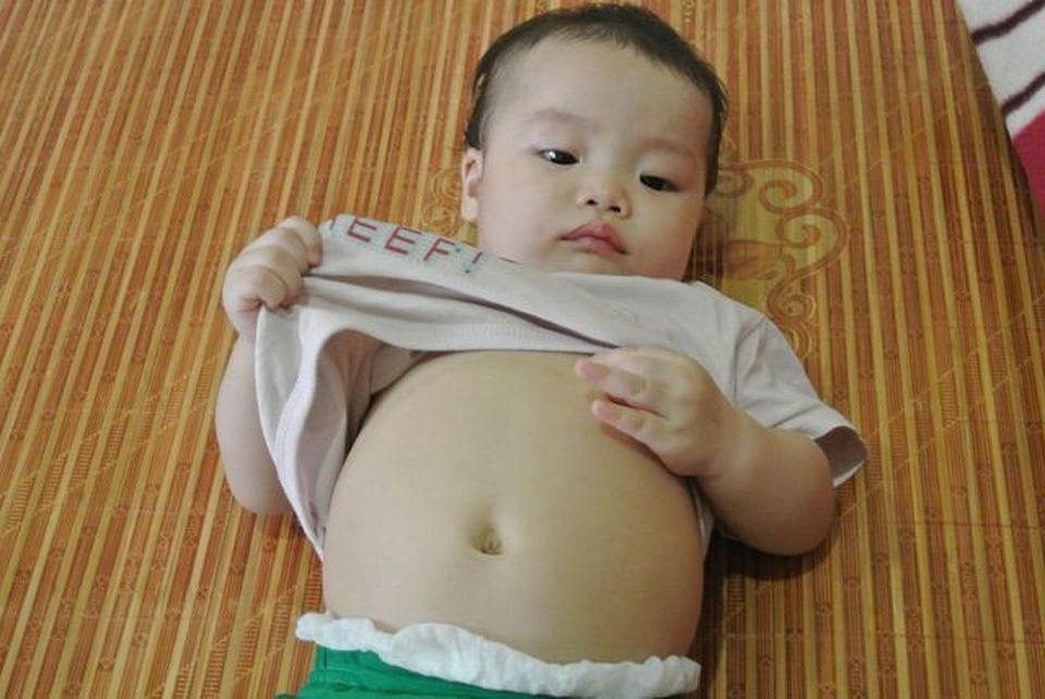 Bạn đọc Dân trí tiếp tục giúp đỡ bé gái bị teo mật bẩm sinh gần 28 triệu đồng - 1 Bạn đọc Dân trí tiếp tục giúp đỡ bé gái bị teo mật bẩm sinh gần 28 triệu đồng - 1