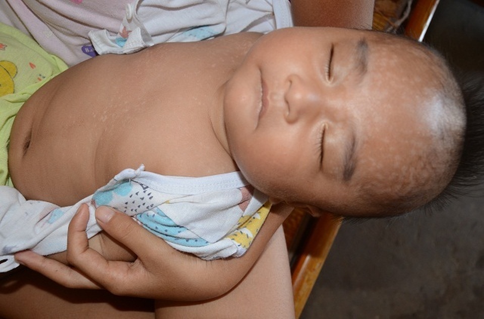 Lời khẩn cầu của người cha ung thư: Mong các bác cho con có hộp sữa là mãn nguyện rồi! - 12 Lời khẩn cầu của người cha ung thư: Mong các bác cho con có hộp sữa là mãn nguyện rồi! - 12