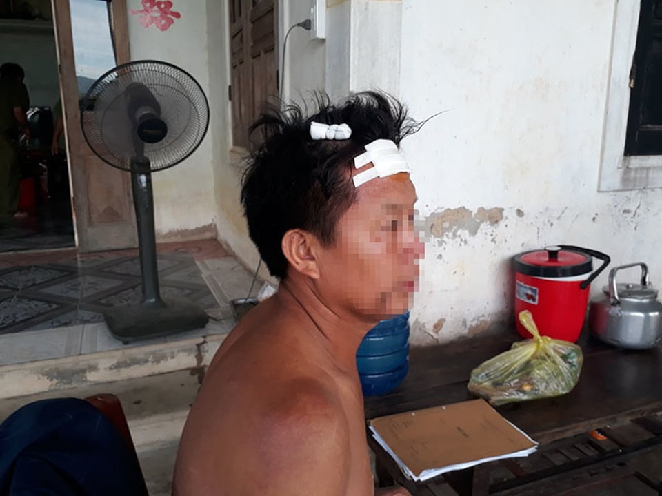 “Cẩu tặc” đánh toác đầu người dân khi bị phát hiện - 1 “Cẩu tặc” đánh toác đầu người dân khi bị phát hiện - 1