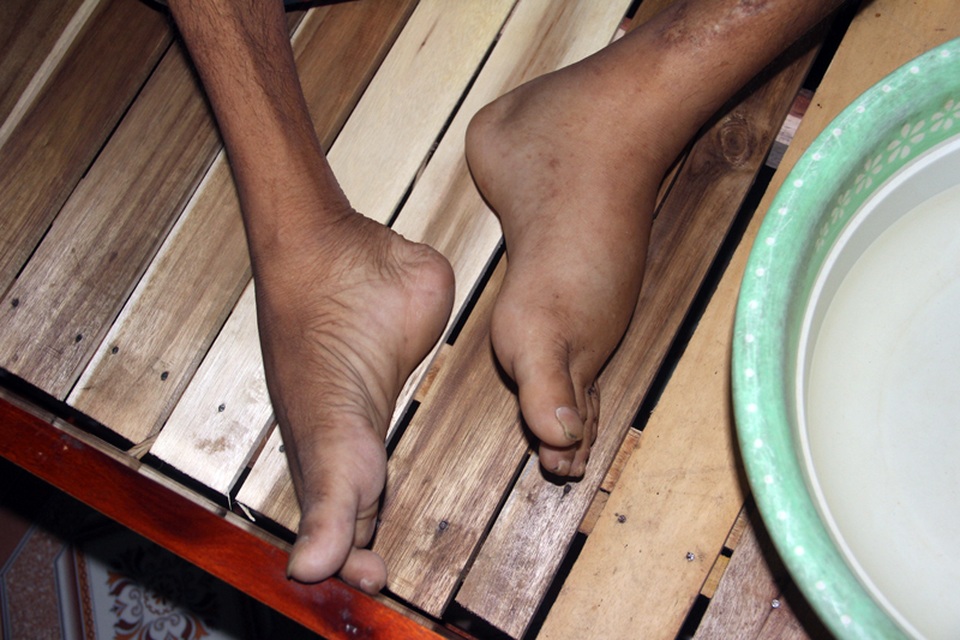 Tận cùng nỗi đau của người đàn ông đơn độc bị bệnh tật đọa đày gầy trơ xương - 3 Tận cùng nỗi đau của người đàn ông đơn độc bị bệnh tật đọa đày gầy trơ xương - 3