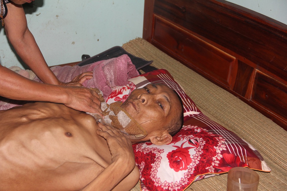 Tận cùng nỗi đau của người đàn ông đơn độc bị bệnh tật đọa đày gầy trơ xương - 8 Tận cùng nỗi đau của người đàn ông đơn độc bị bệnh tật đọa đày gầy trơ xương - 8