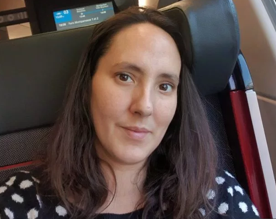 Làm đẹp không phòng bị cẩn thận, cô gái phải cắt bỏ một phần mũi - 4