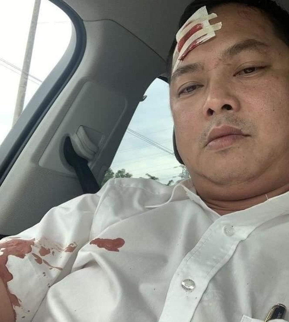 Vụ giang hồ “vây” xe chở công an: Xuất hiện người nghi bị nhóm công an đánh - 1 Vụ giang hồ “vây” xe chở công an: Xuất hiện người nghi bị nhóm công an đánh - 1