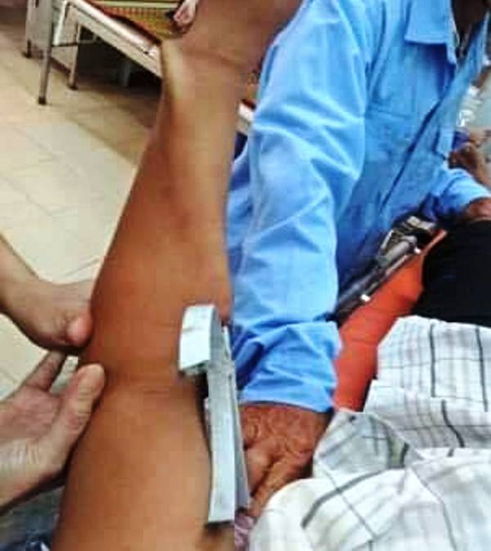 Nổi da gà với hình ảnh bảo vệ bị cọc sắt đâm dính chặt tay vào tường rào - 1 Nổi da gà với hình ảnh bảo vệ bị cọc sắt đâm dính chặt tay vào tường rào - 1