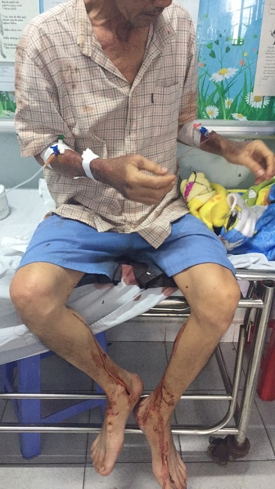 Người đàn ông độc thân nằm chờ chết trên vũng máu - 1 Người đàn ông độc thân nằm chờ chết trên vũng máu - 1