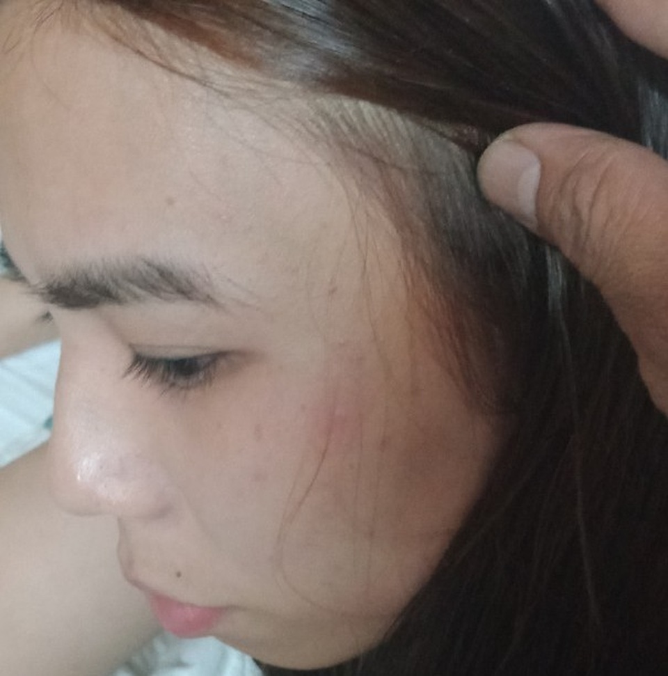 Không tìm được chồng, nhóm thanh niên xuống tay đánh vợ nhập viện ! - 3 Không tìm được chồng, nhóm thanh niên xuống tay đánh vợ nhập viện ! - 3