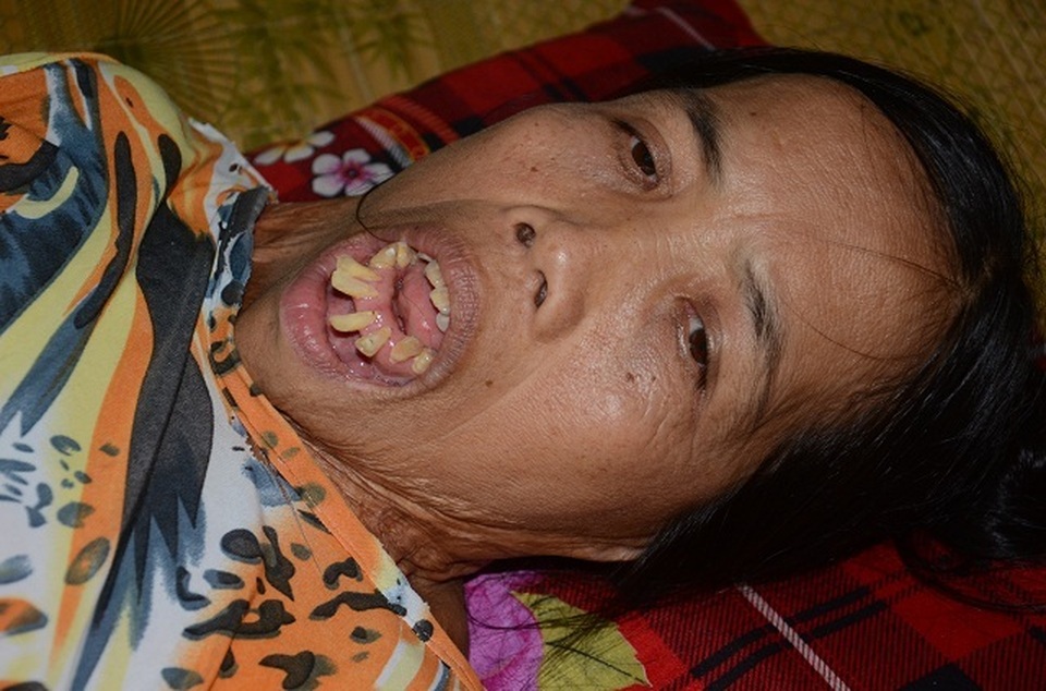 Người đàn bà nửa thế kỉ mang hàm răng kì dị và chưa một lần ngoái cổ - 1 Người đàn bà nửa thế kỉ mang hàm răng kì dị và chưa một lần ngoái cổ - 1