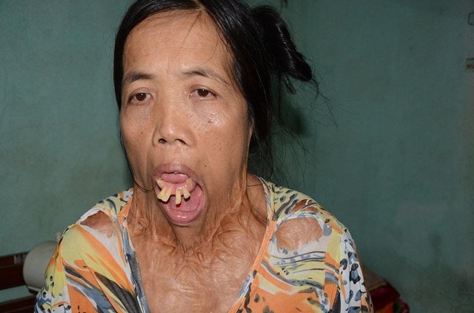 Người đàn bà nửa thế kỉ mang hàm răng kì dị và chưa một lần ngoái cổ - 3 Người đàn bà nửa thế kỉ mang hàm răng kì dị và chưa một lần ngoái cổ - 3