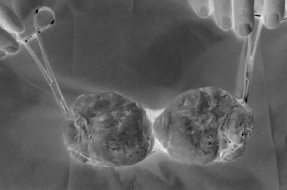 Nhiều nam giới còn trẻ đã “mất đạn” vì bệnh nguy hiểm - 1