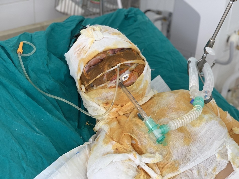 Đớn đau thảm cảnh gia đình 4 người bị thiêu sống: Hãy cứu tính mạng 2 bà cháu - 11 Đớn đau thảm cảnh gia đình 4 người bị thiêu sống: Hãy cứu tính mạng 2 bà cháu - 11