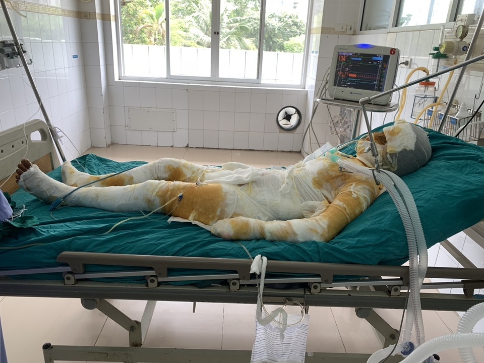 Đớn đau thảm cảnh gia đình 4 người bị thiêu sống: Hãy cứu tính mạng 2 bà cháu - 5 Đớn đau thảm cảnh gia đình 4 người bị thiêu sống: Hãy cứu tính mạng 2 bà cháu - 5