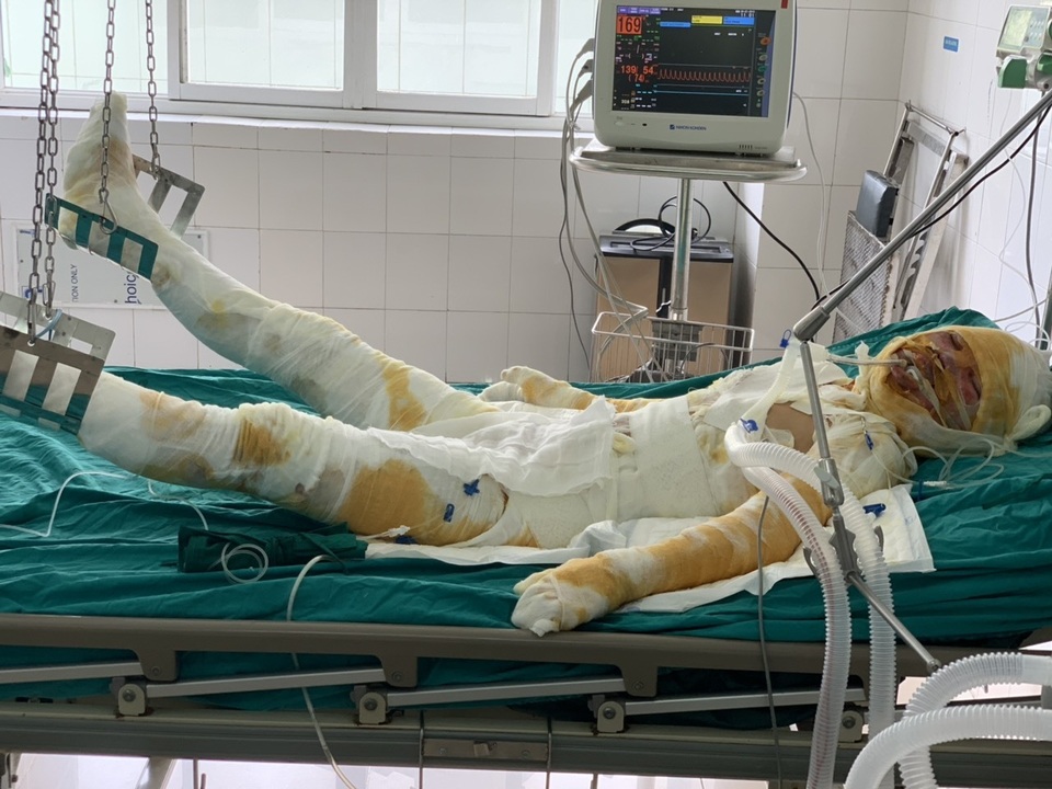 Đớn đau thảm cảnh gia đình 4 người bị thiêu sống: Hãy cứu tính mạng 2 bà cháu - 1 Đớn đau thảm cảnh gia đình 4 người bị thiêu sống: Hãy cứu tính mạng 2 bà cháu - 1