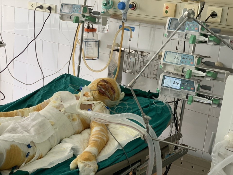 Đớn đau thảm cảnh gia đình 4 người bị thiêu sống: Hãy cứu tính mạng 2 bà cháu - 3 Đớn đau thảm cảnh gia đình 4 người bị thiêu sống: Hãy cứu tính mạng 2 bà cháu - 3