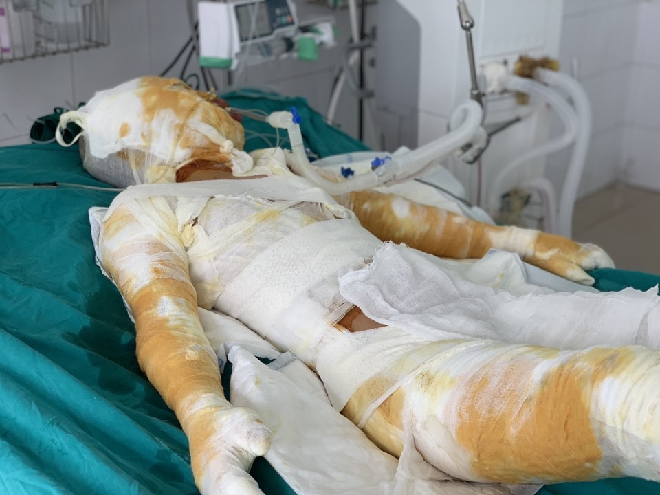 Đớn đau thảm cảnh gia đình 4 người bị thiêu sống: Hãy cứu tính mạng 2 bà cháu - 8 Đớn đau thảm cảnh gia đình 4 người bị thiêu sống: Hãy cứu tính mạng 2 bà cháu - 8