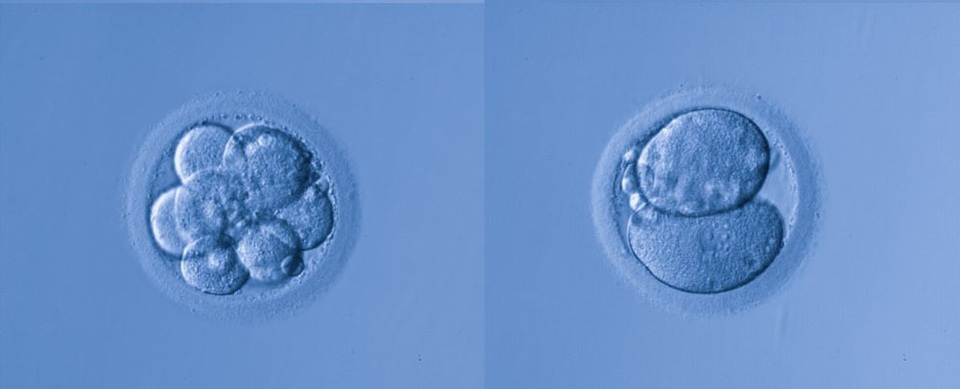 5 cặp vợ chồng người Nga đã đồng ý sử dụng chỉnh sửa gene để con không bị điếc? - 1 5 cặp vợ chồng người Nga đã đồng ý sử dụng chỉnh sửa gene để con không bị điếc? - 1