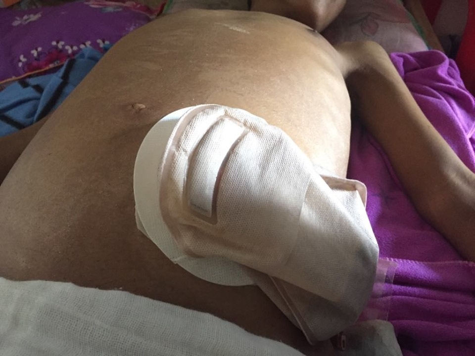 Cụ bà gần đất xa trời cơ cực đút cho cháu trai trọng bệnh từng thìa cháo! - 4 Cụ bà gần đất xa trời cơ cực đút cho cháu trai trọng bệnh từng thìa cháo! - 4