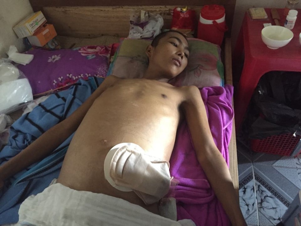 Cụ bà gần đất xa trời cơ cực đút cho cháu trai trọng bệnh từng thìa cháo! - 3 Cụ bà gần đất xa trời cơ cực đút cho cháu trai trọng bệnh từng thìa cháo! - 3