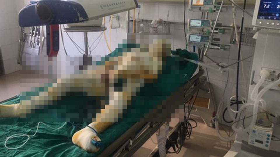 Nghi can phóng hỏa thiêu cả nhà người tình ở Sơn La đã tử vong - 1 Nghi can phóng hỏa thiêu cả nhà người tình ở Sơn La đã tử vong - 1