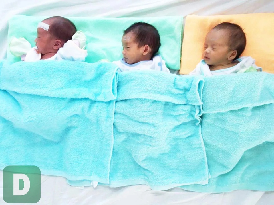 Sản phụ sinh 3 hiếm gặp tại Huế - 1 Sản phụ sinh 3 hiếm gặp tại Huế - 1