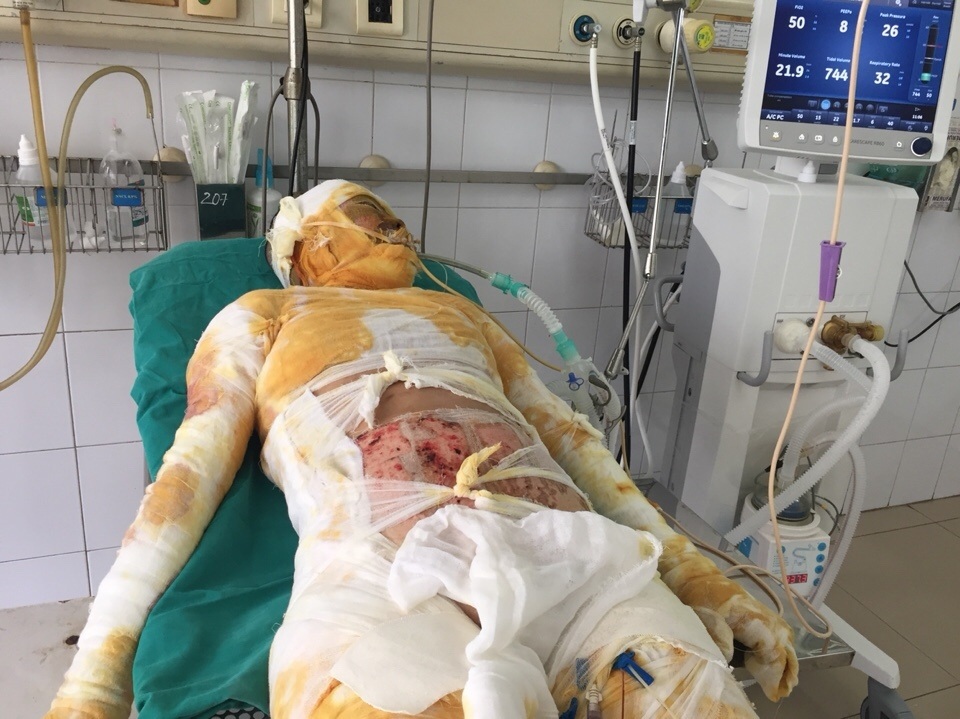 Vụ cả nhà 4 người bị thiêu sống, chỉ còn cô bé 9 tuổi sống sót - 2 Vụ cả nhà 4 người bị thiêu sống, chỉ còn cô bé 9 tuổi sống sót - 2