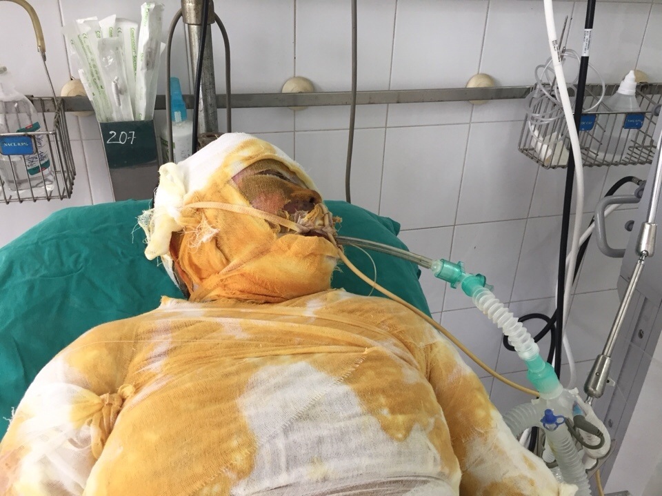 Vụ cả nhà 4 người bị thiêu sống, chỉ còn cô bé 9 tuổi sống sót - 3 Vụ cả nhà 4 người bị thiêu sống, chỉ còn cô bé 9 tuổi sống sót - 3